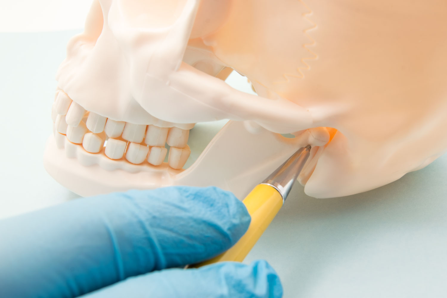 Dentist pointing at the TMJ on a fake skull to indicate TMJ dysfunction or TMD