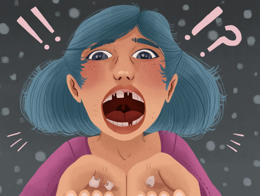 Graphic illustration of woman with loose dental implants.